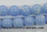 CTU1737 15.5 inches 16mm round synthetic turquoise beads